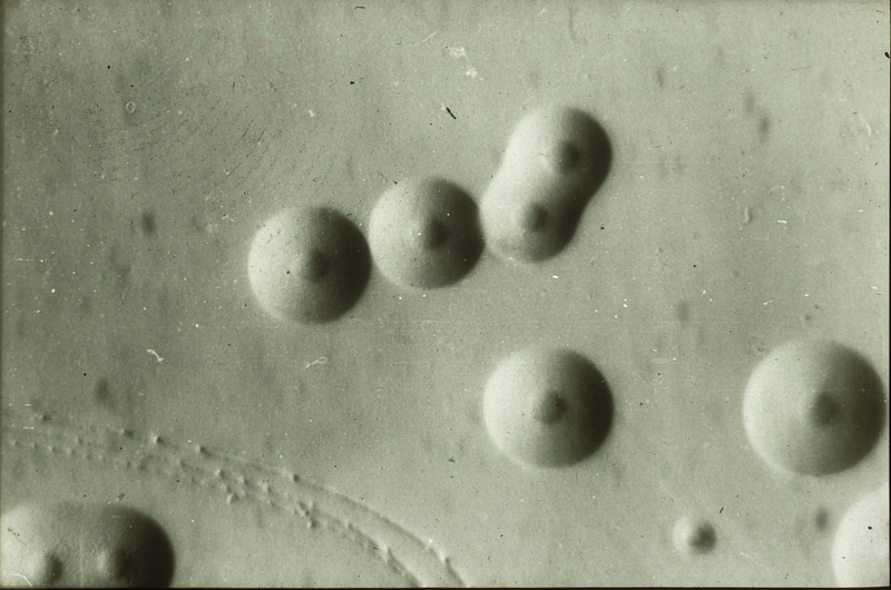 Item from a series of AAAP records containing slide study sets, which consist of slides and their accompanying texts. The slide study sets mainly cover poultry diseases and their diagnosis, but also include other topics such as biotechnology in avian medicine and careers in avian medicine.