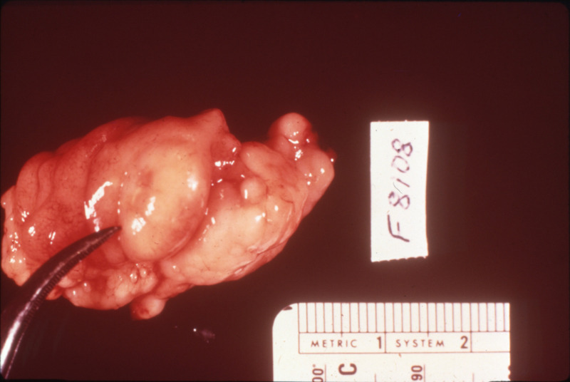 Item from a series of AAAP records containing slide study sets which consist of slides and their accompanying texts. The slide study sets mainly cover poultry diseases and their diagnosis, but also include other topics such as biotechnology in avian medicine and careers in avian medicine.