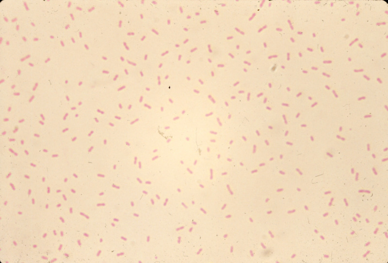 Item from a series of AAAP records containing slide study sets which consist of slides and their accompanying texts. The slide study sets mainly cover poultry diseases and their diagnosis, but also include other topics such as biotechnology in avian medicine and careers in avian medicine.