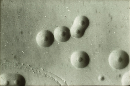 Item from a series of AAAP records containing slide study sets, which consist of slides and their accompanying texts. The slide study sets mainly cover poultry diseases and their diagnosis, but also include other topics such as biotechnology in avian medicine and careers in avian medicine.