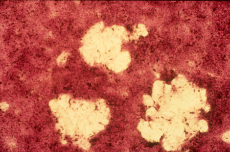 Item from a series of AAAP records containing slide study sets which consist of slides and their accompanying texts. The slide study sets mainly cover poultry diseases and their diagnosis, but also include other topics such as biotechnology in avian medicine and careers in avian medicine.