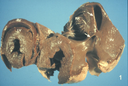 Item from a series of AAAP records containing slide study sets which consist of slides and their accompanying texts. The slide study sets mainly cover poultry diseases and their diagnosis, but also include other topics such as biotechnology in avian medicine and careers in avian medicine.