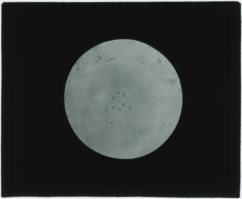 Bacteria specimen (black and white).