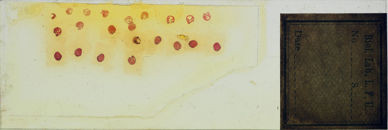 Microscope slide of cross section of open neural groove.