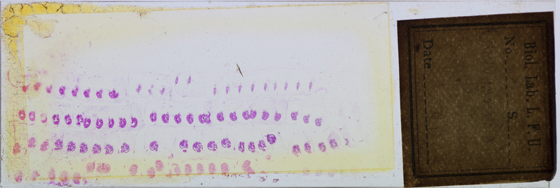 Microscope slide of unidentified insect parts. Slide label unclear but may say over growing ofur. cross section.