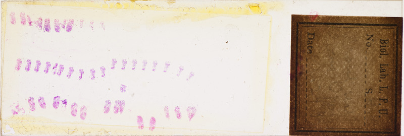 Microscope slide of front. sect. over g. open.